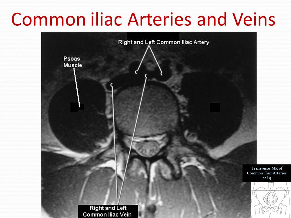 247 Pelvic Vasculature Musculature.jpg